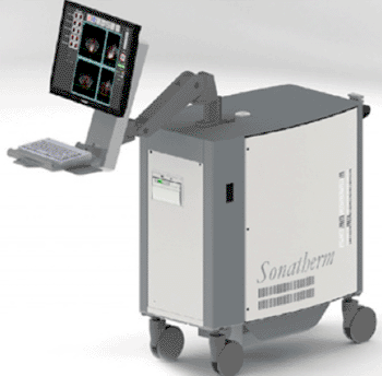 Imagen: El sistema de ablación quirúrgica Sonatherm HIFU (Fotografía cortesía de SonaCare Medical).